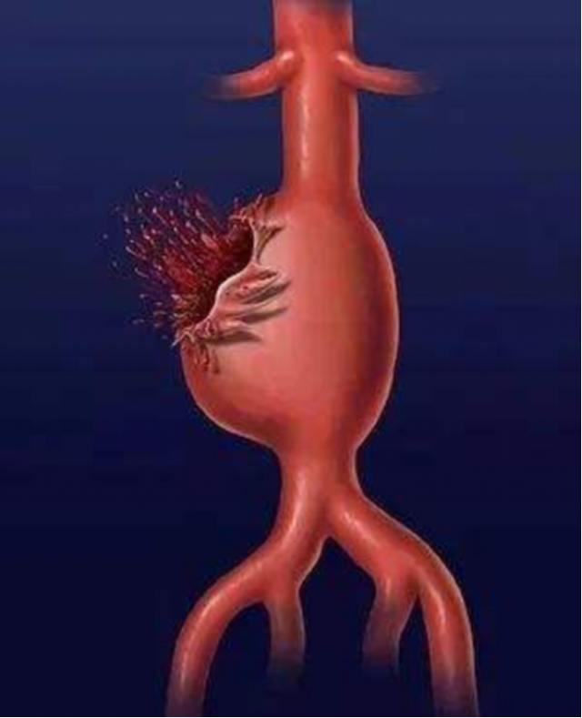 婚姻破裂怎么挽救 挽回婚姻的实用方法