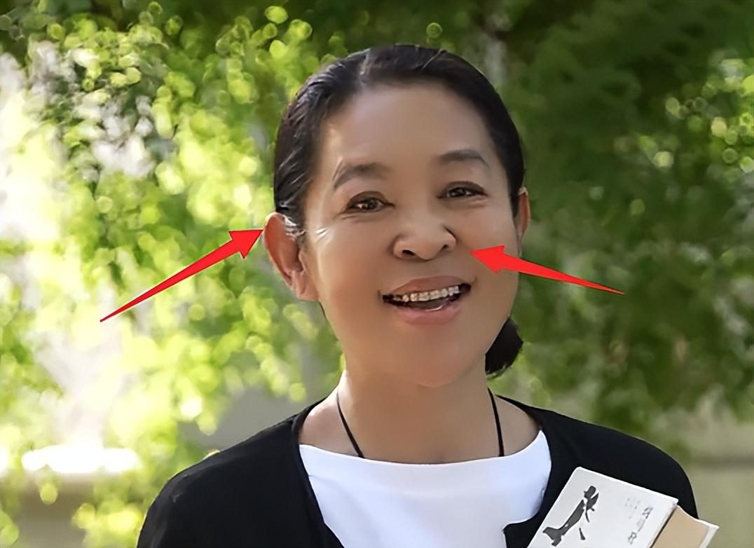 倪萍暴瘦后体重反弹,鼻孔外翻被质疑整容,满脸褶子衰老不少__财经头条