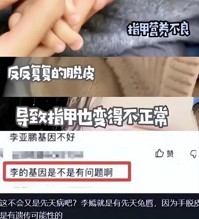 李亚鹏承认欠债 4000 万，吐苦水曝公司已裁 200 人，债台高筑无力还