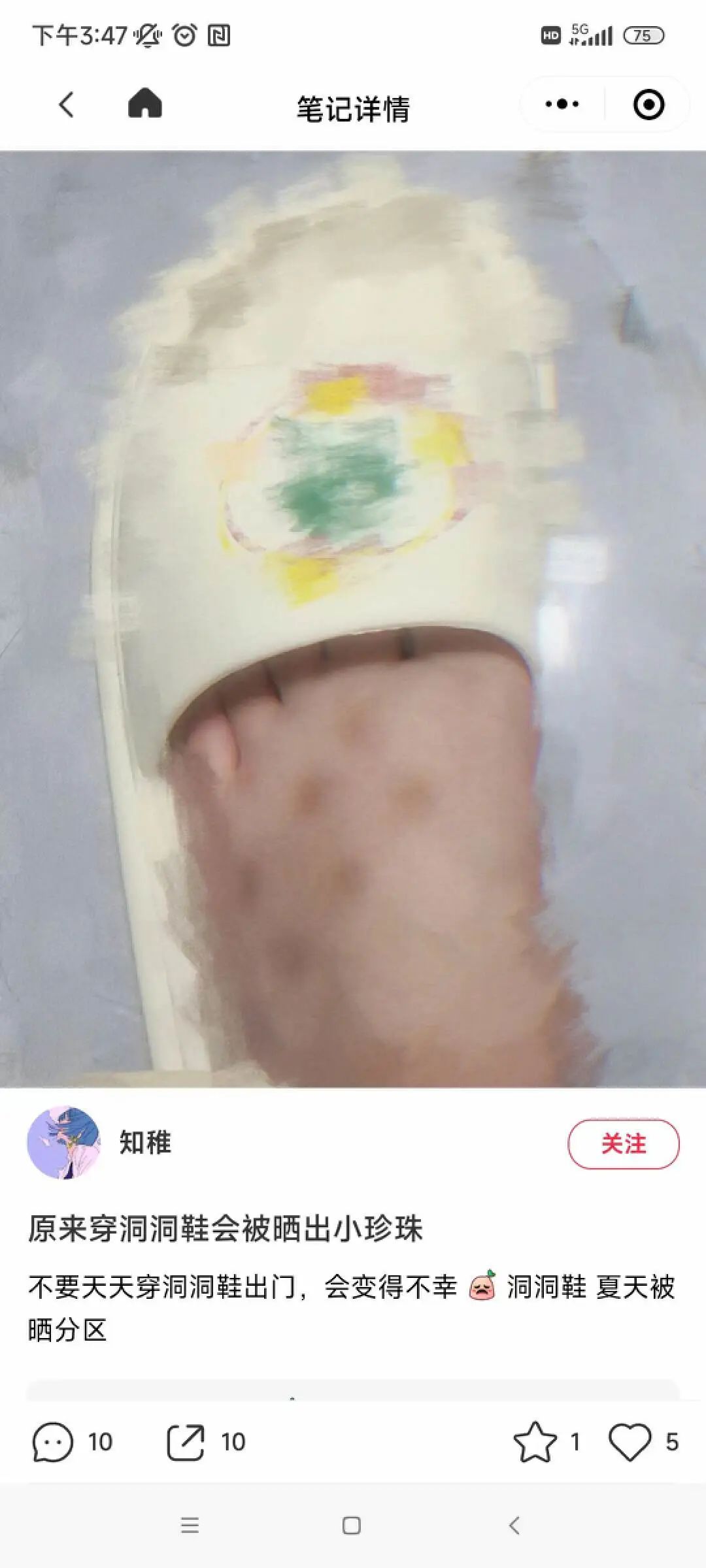 剥离子怎么使用为什么医生护士都爱穿洞洞鞋？_https://www.jmylbn.com_新闻资讯_第15张