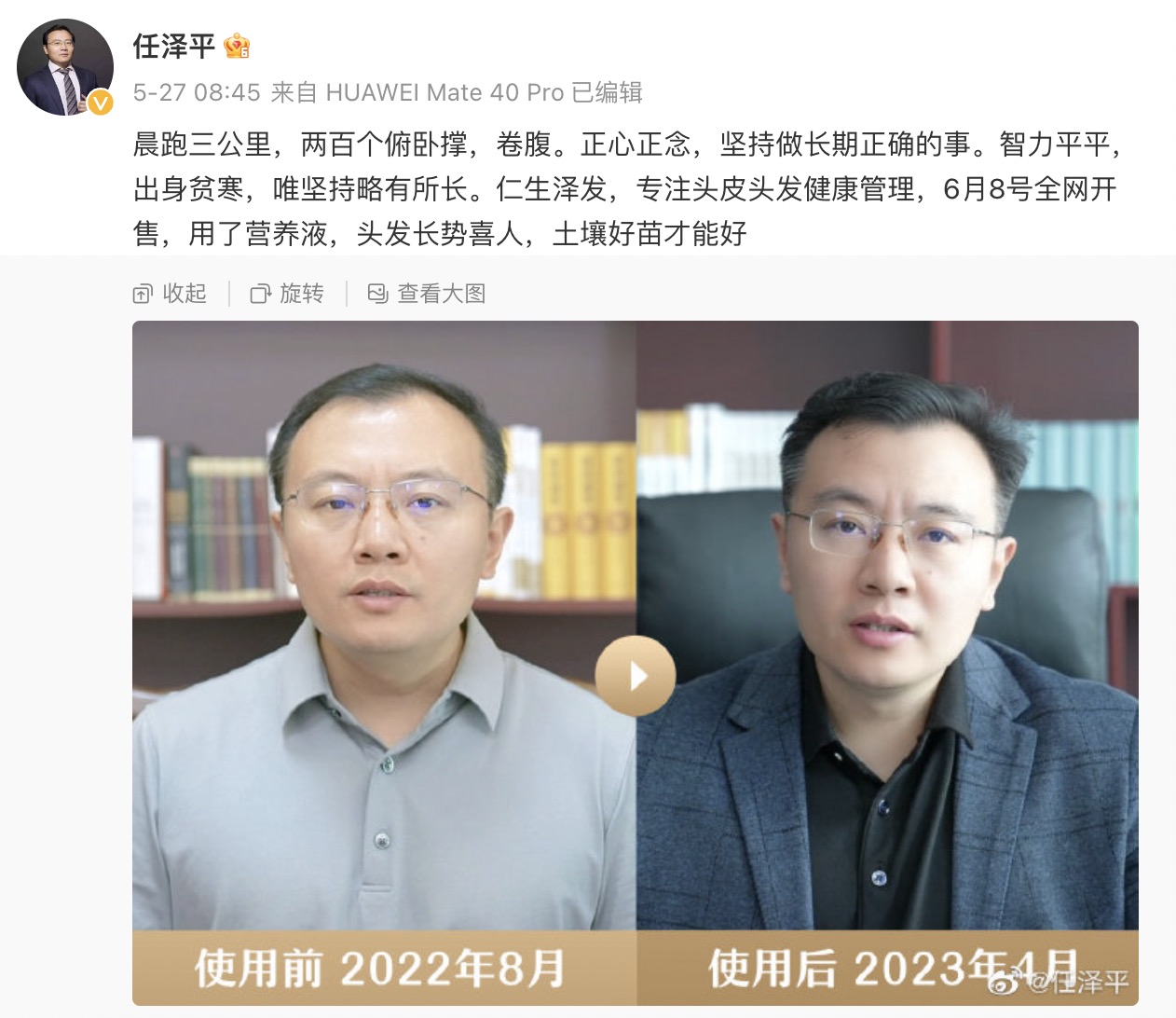 挺秃然的!“网红经济学家”任泽平带货生发液__财经头条