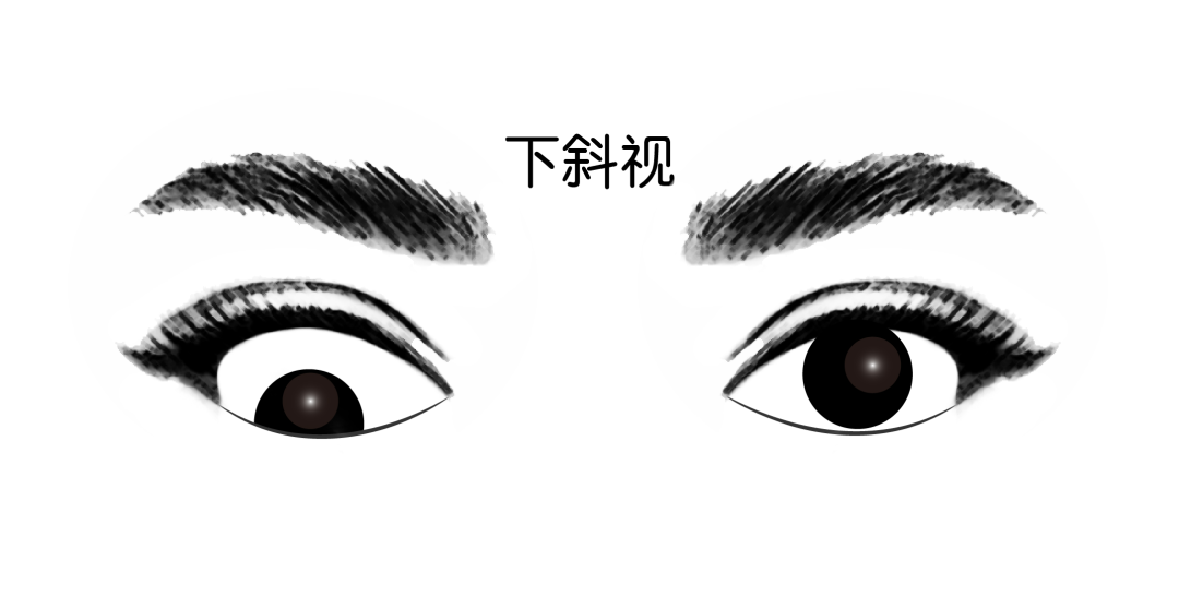 真假斜视,和睦家眼科医生教您辨别