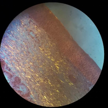 图丨彩色正交偏振显微镜下，正常组织的固有层分布有源自双折射的金黄色纤维状结构（来源：祁绩）