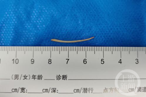 更年期潮热失眠、皮肤干？这三道食补方吃出好气色v5.4.7 官方安卓版