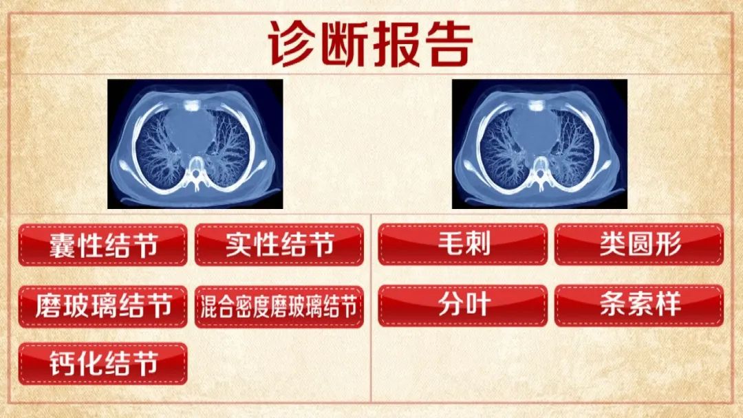 北京胸科医院就诊支持CT加急-北京胸科医院就诊支持ct加急吗 北京胸科医院就诊支持CT加急-北京胸科医院就诊支持ct加急吗