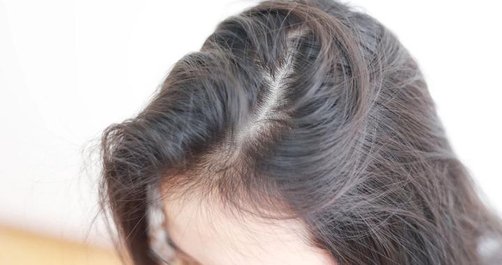 白头发越长越多怎么办?若能及时补充3种营养素,或能白发变黑发|蛋白质|维生素_新浪新闻