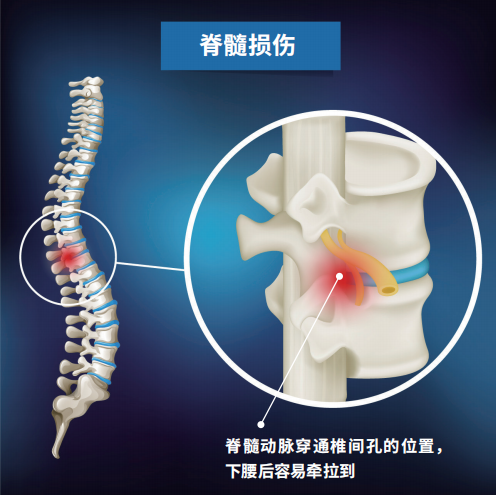 瘫痪病人怎么护理视频3周内接诊5例，教育部、中消协发出提醒！“下腰瘫”是怎么回事？_https://www.jmylbn.com_新闻资讯_第9张