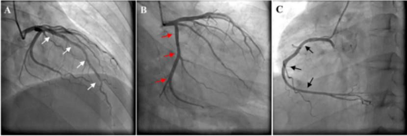 千万别只想到急性心梗!|马修