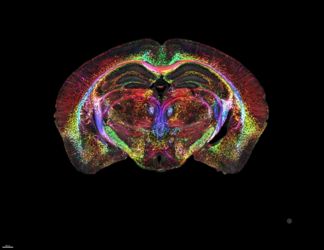 为什么医疗设备这么贵实现国产量产！制造这颗“尖端医疗设备皇冠上的明珠”为什么难？_https://www.jmylbn.com_新闻资讯_第3张