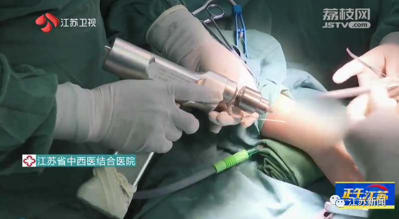 什么骨科是实心电钻电钻、砧板、镜子、细针……他们用十八般“兵器”练就十八般“武艺”！-上海聚慕医疗器械有限公司