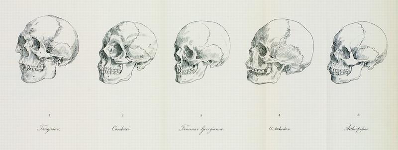 布鲁门巴哈测定的五种人的头盖骨