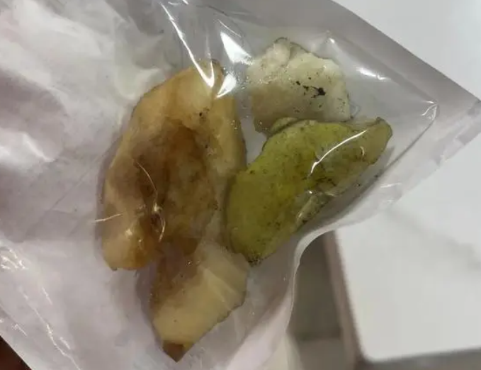 超高龄+心脏疾病双重考验，海宁50多岁孕妇平安产子