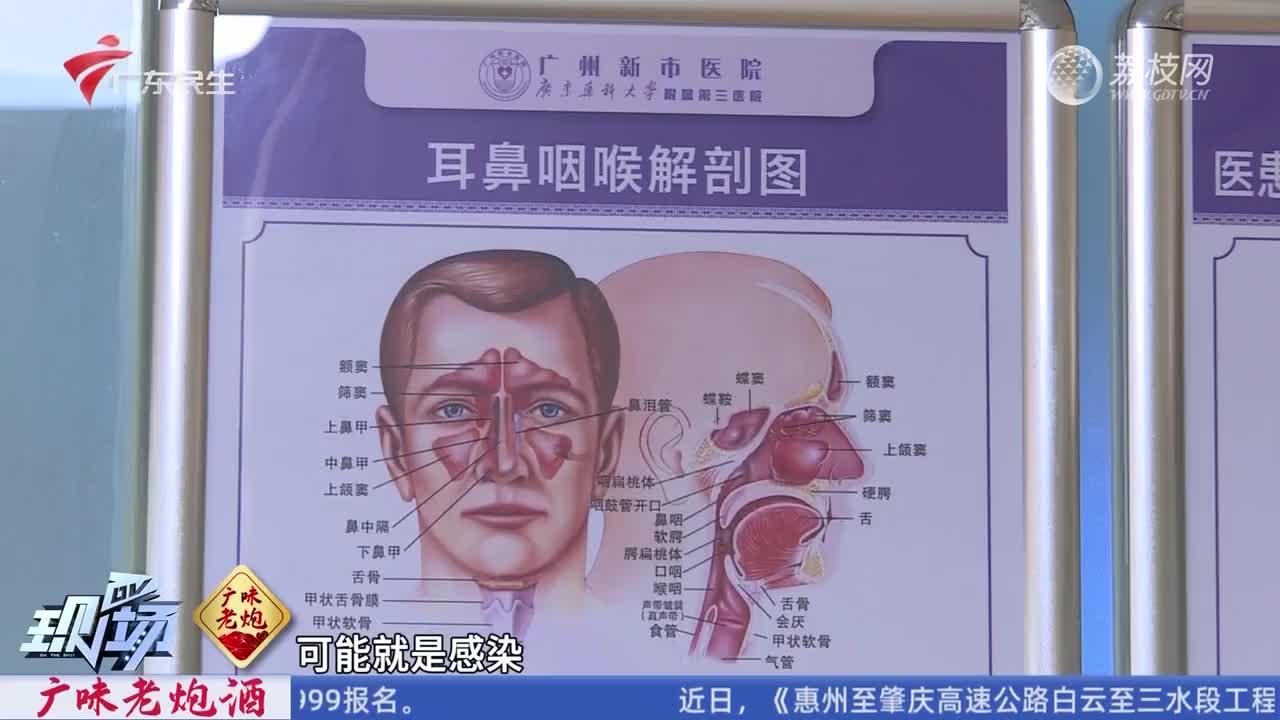 女生称因爱抠鼻子 致鼻内长10多团真菌_新浪新闻