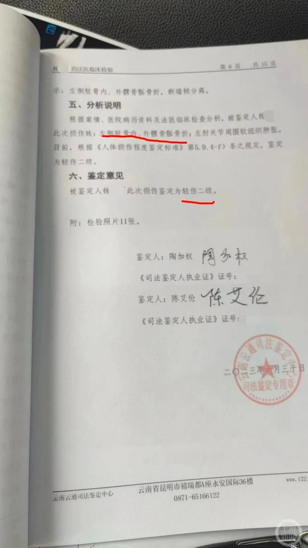 根据案情,医院病历资料及法医临床检查分析,被鉴定人杨某某此次损伤致