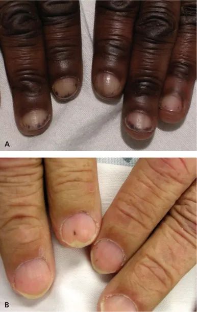 这几种情况才真的需要注意……|疾病_新浪财经_新浪网