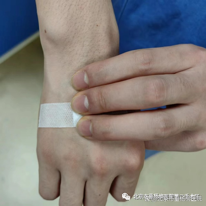 垂医科普 | 拔针后如何正确按压?_新浪财经_新浪网