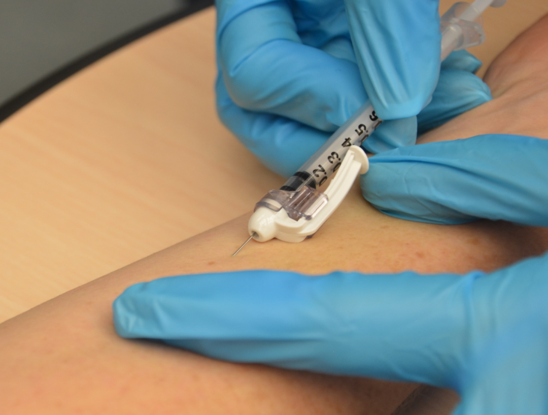 看着都疼的做"皮试".(图/wikimedia)