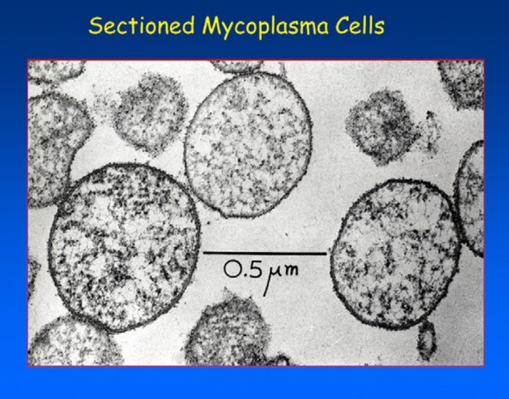 能看到细胞内的dna链(细线)和核糖体(深色颗粒).