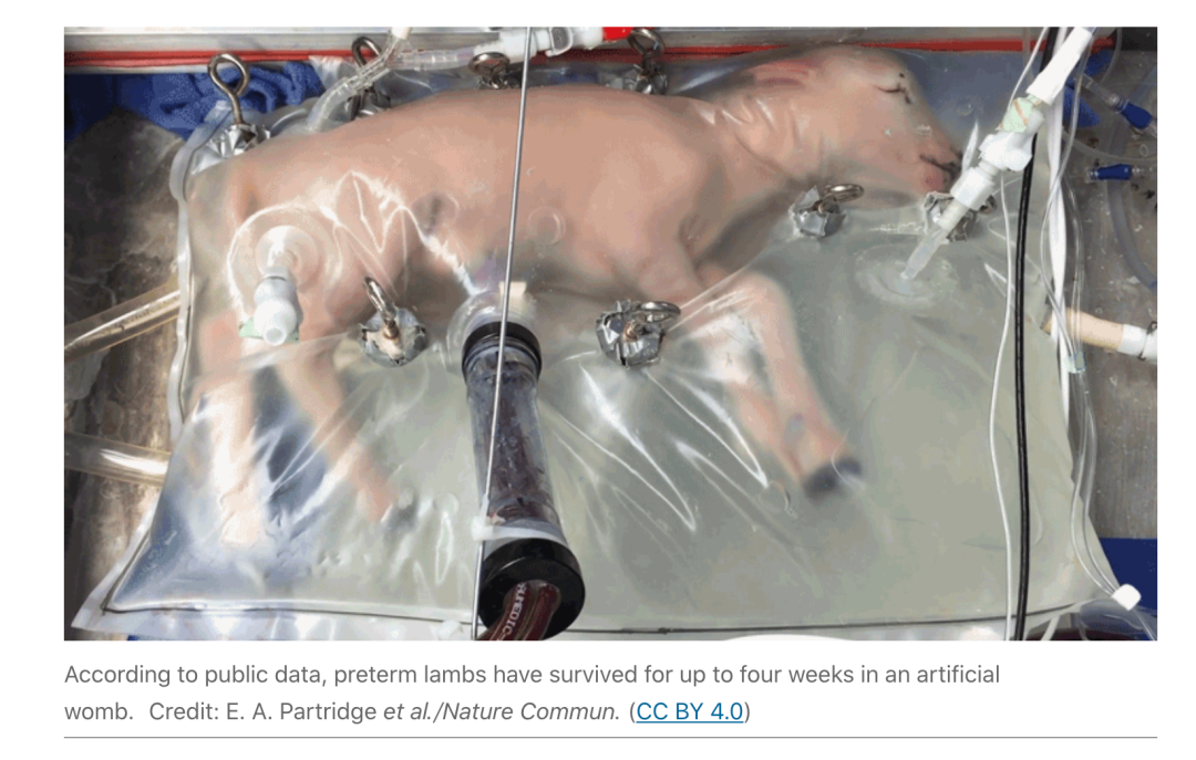 费城儿童医院公布的羊胎在人造子宫内的实验图.