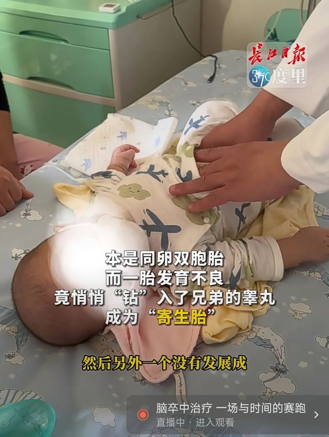 罕见!4月男婴睾丸内取出一个"娃"