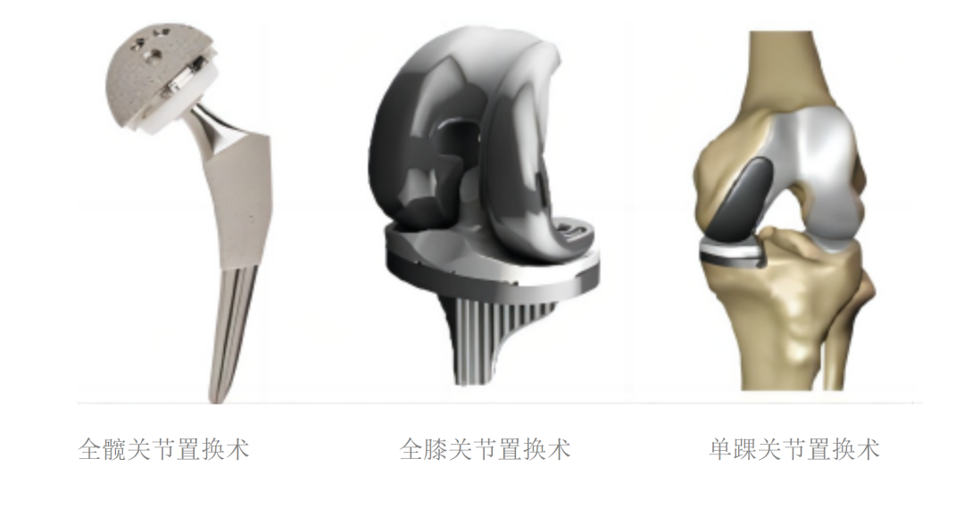 为什么骨科用摆锯华南首例！MAKO机器人辅助完成单髁置换术，术后第一天就能独立行走_https://www.jmylbn.com_新闻资讯_第11张