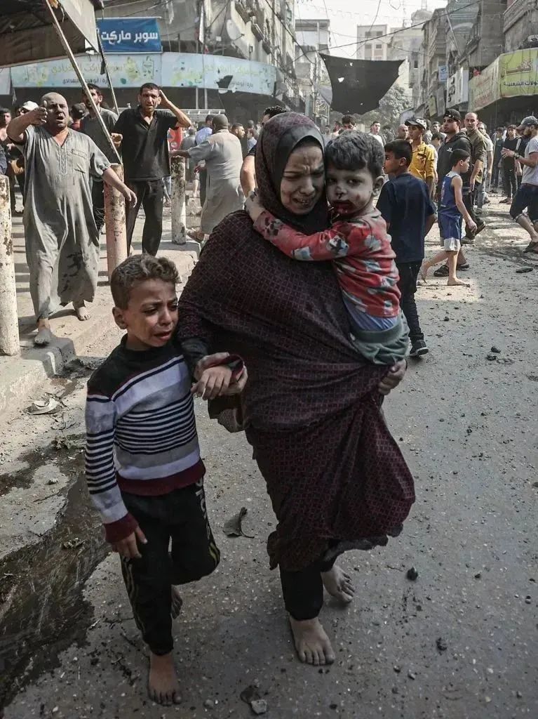 以色列空袭加沙地带中部的布赖杰难民营,受伤的一名妇女和两名儿童