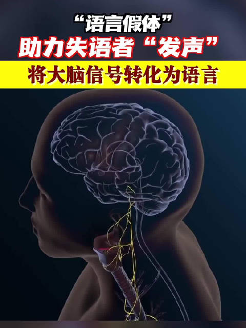 将大脑信号转化为想要说的话 语言假体助力失语者发声_新浪新闻