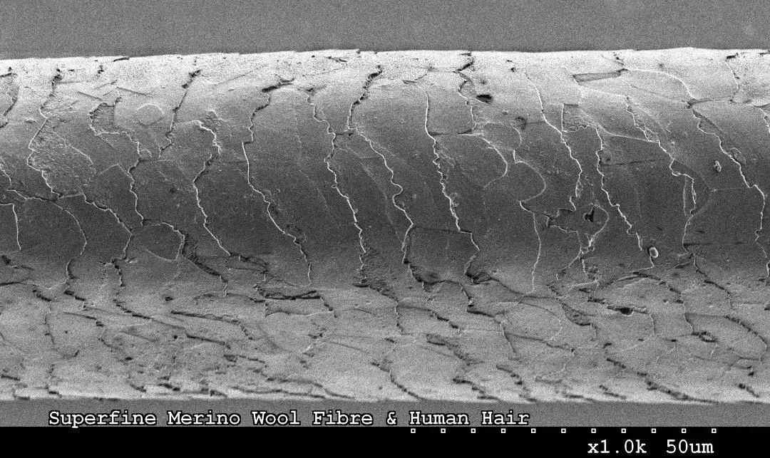 电子显微镜下头发上的毛鳞片.(图/wikipedia)