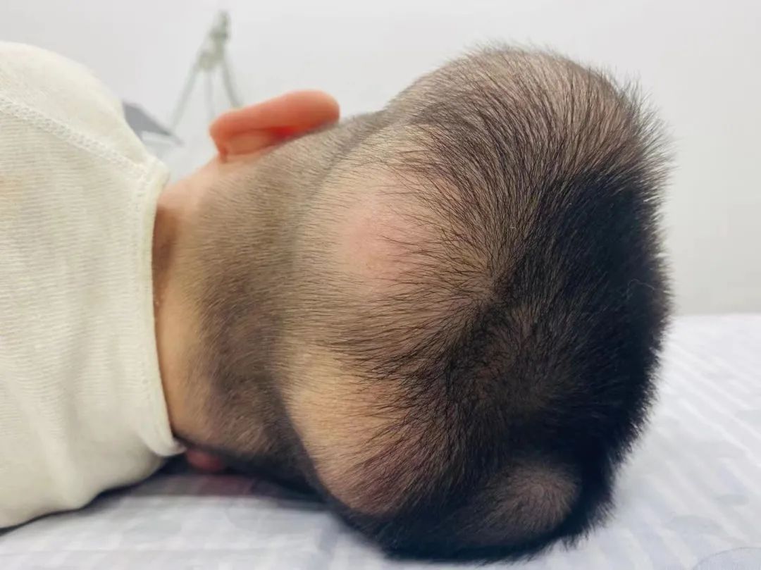 两三年前的桐桐,头部已经长满了鸡蛋大小的肿瘤.