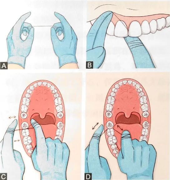 牙线的使用方法.