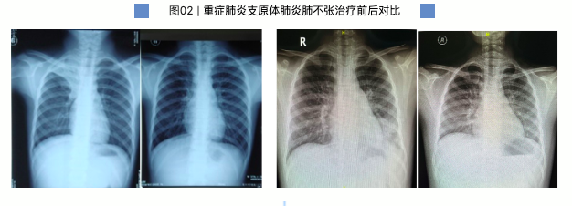 《蜜语纪》收官在即，李梦曝朱珠组团蹭饭，理由超逗