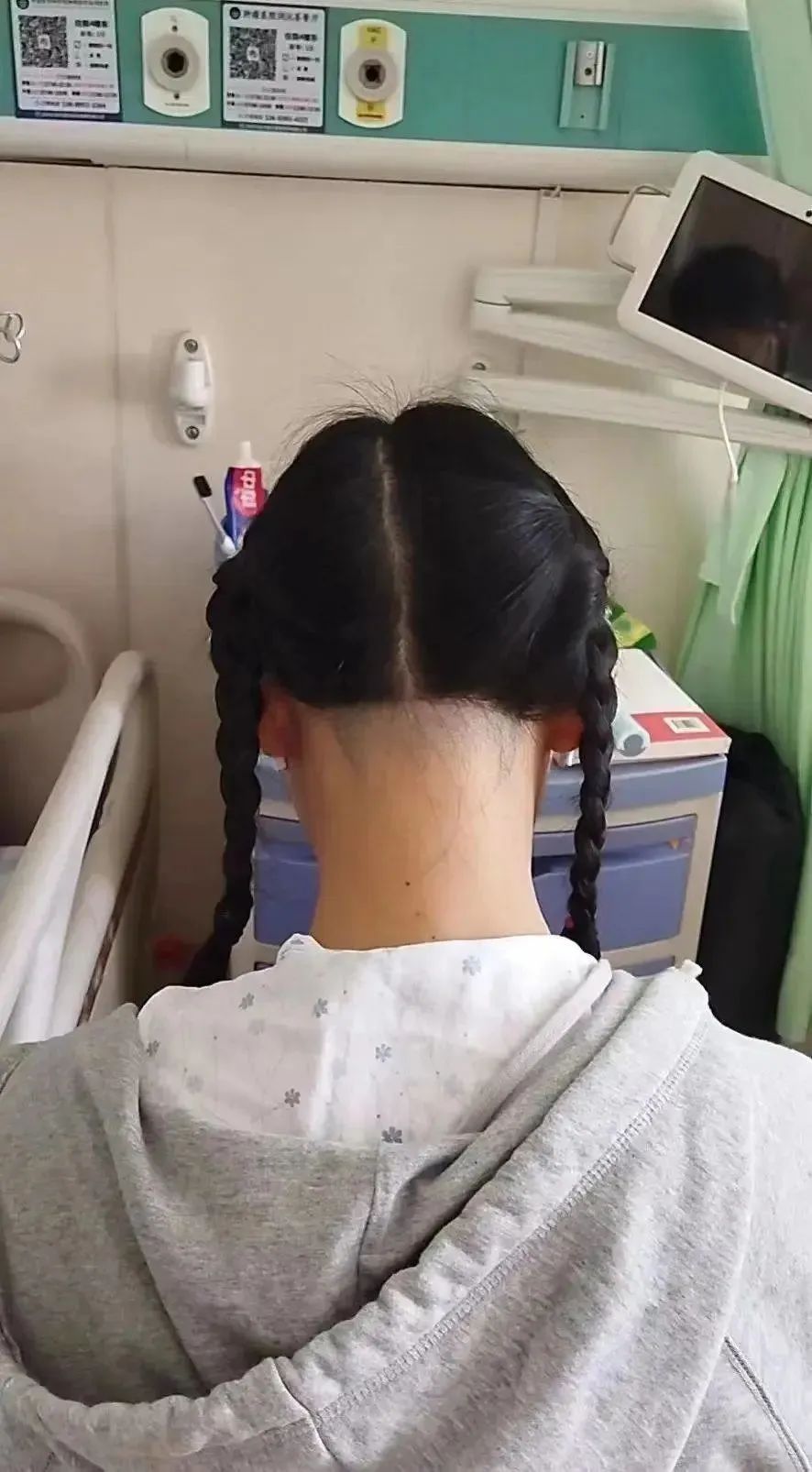 术前准备时小袁剃了一部分头发.(图/受访者供图)