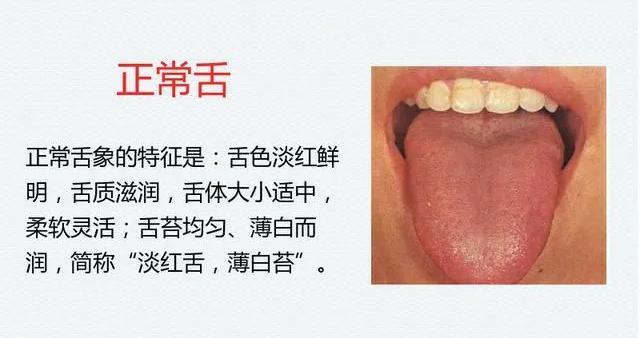 《中医舌诊》,23张高清案例图,一看就懂|中医舌诊_新浪新闻