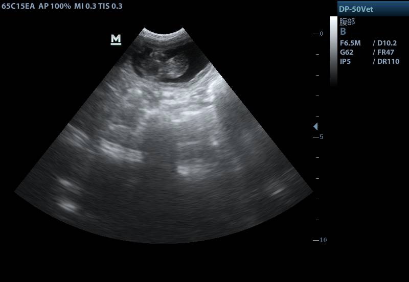 宫角妊娠b超诊断报告图片