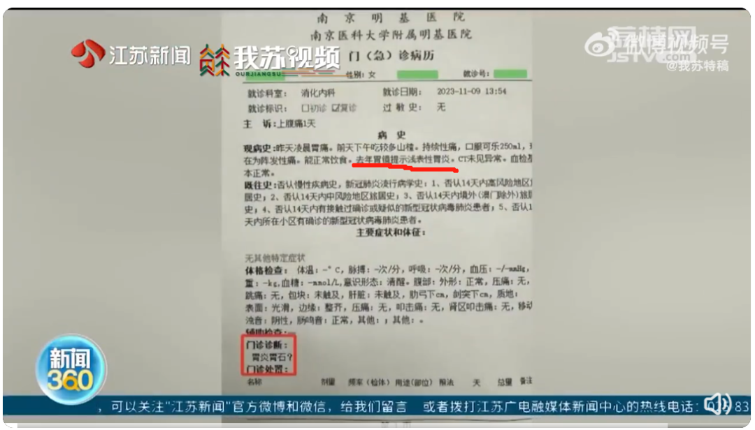 该网友去年做胃镜就已经是浅表性胃炎,实际病史可能更久.