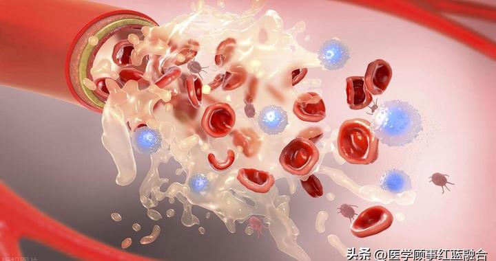 一眼两命！北大医生：颅内大量出血，腹腔大出血|腹腔|北京大学|急诊_新浪新闻