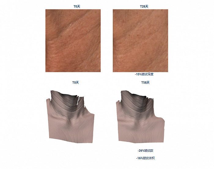 Col-4-Frag remastered 改善肩颈皮肤皱纹的可视化试验