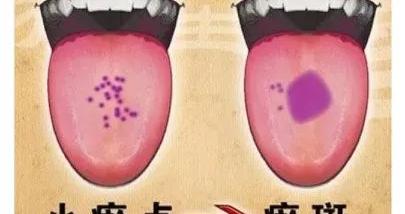 中医总看舌头,都在看什么?九种体质+舌诊图谱|中医|体质_新浪新闻