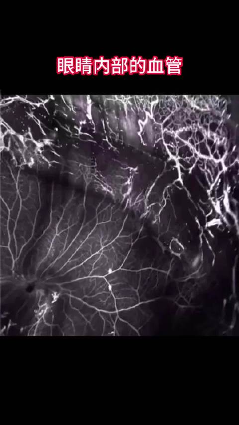 从脉络膜到瞳孔,眼睛内部相互连接的血管网,小宇宙一般_新浪新闻