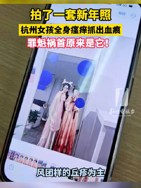 拍完写真照,姑娘浑身奇痒无比,原因令人咋舌 一套新年照拍完……|过敏_新浪新闻