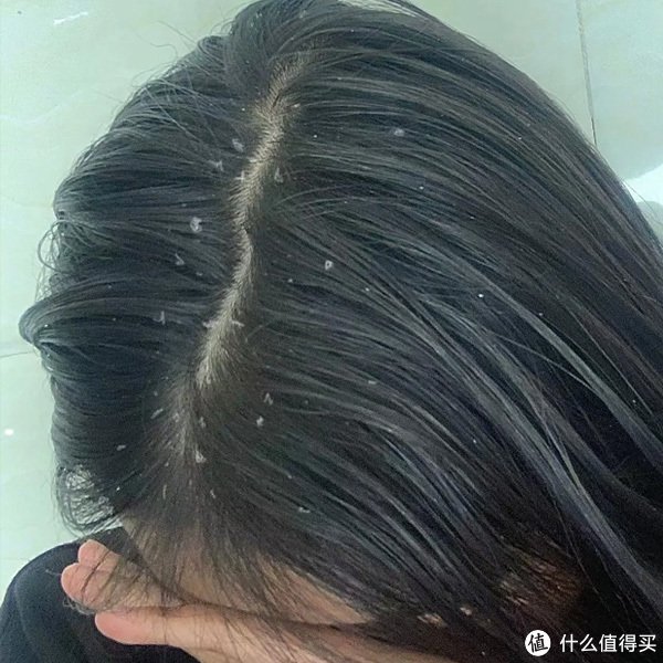 头痒头皮多用什么洗发水?中国最安全的洗发水|止痒|洗发乳|瘙痒|控油|护发_新浪新闻