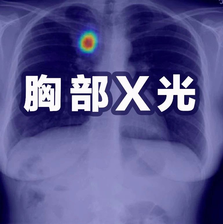 放射科医生再临危机!国外五大机构联合发布「胸部X光」最新基准|医学_新浪新闻