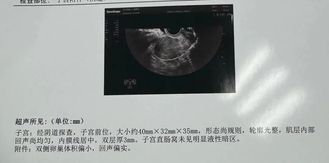 而且b超显示小张双侧卵巢体积偏小,回声偏实.最终
