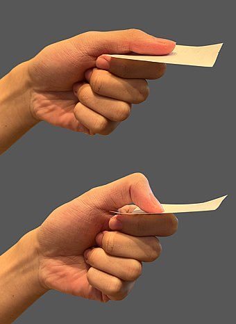 “Froment 征”，应该是骨科内容……|拇指|屈肌|握力|尺神经麻痹|检查者_新浪新闻