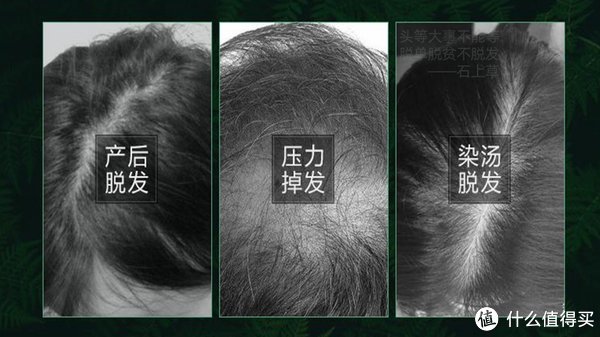 有可以固发防脱洗发水吗