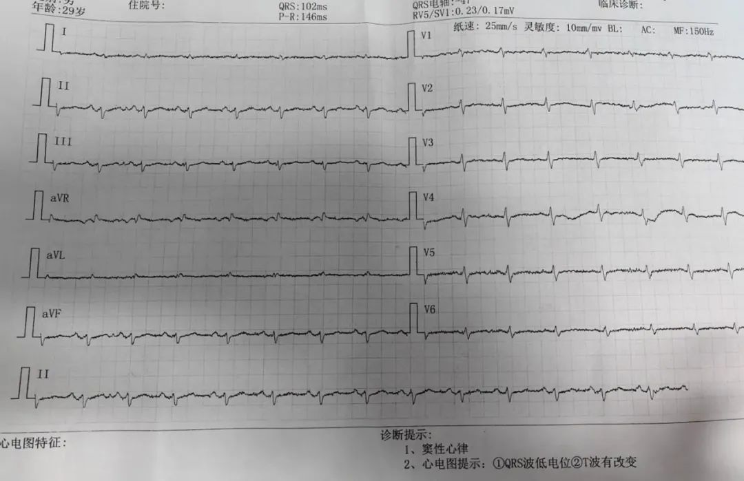 患者的心脏竟消失了!