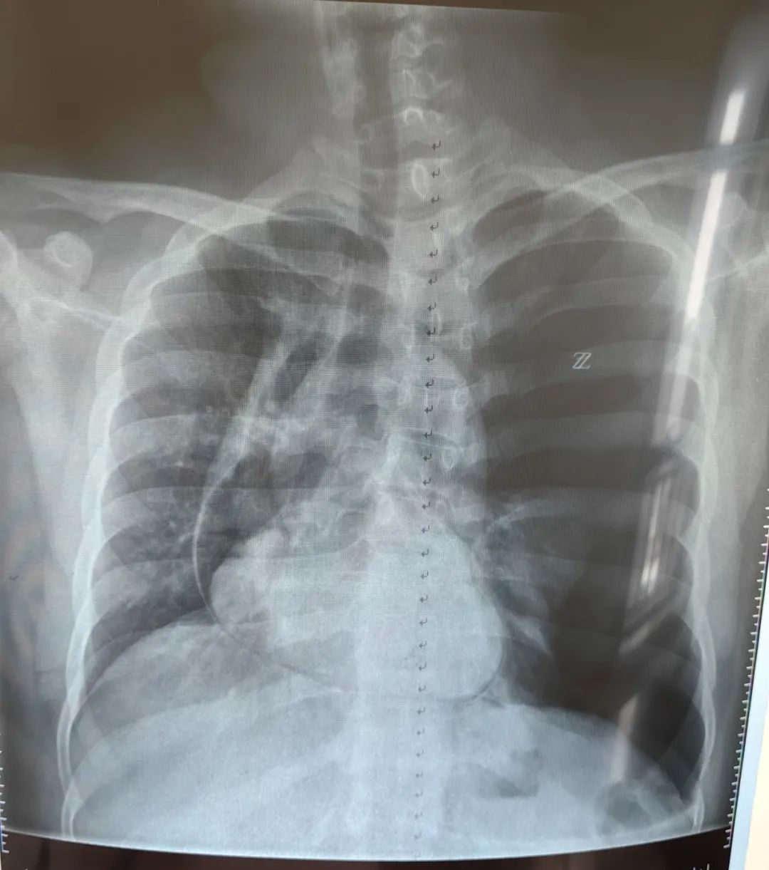 别慌,心电图带你抽丝剥茧找真凶|心电图_新浪财经_新浪网