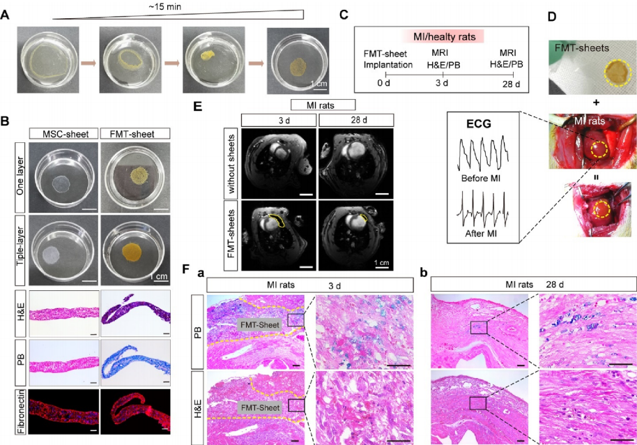 图丨心肌梗死大鼠植入的间充质干细胞补片向梗死心肌迁移并与之整合（来源：ACS Nano）