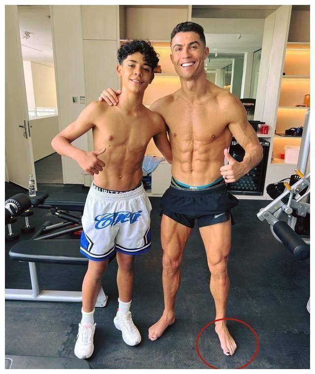 不仅c罗,许多顶级运动员都采取这一保养措施,目的是为了保护脚趾甲免