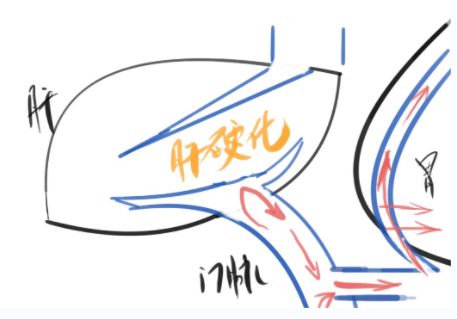 正常的肝脏血管示意图.医护人员强调穿刺注意事项.